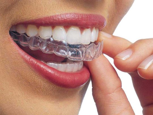 https://estetica-dentale.it/website_4247738d/wp-content/uploads/2024/06/riallineamento-540x405.jpg