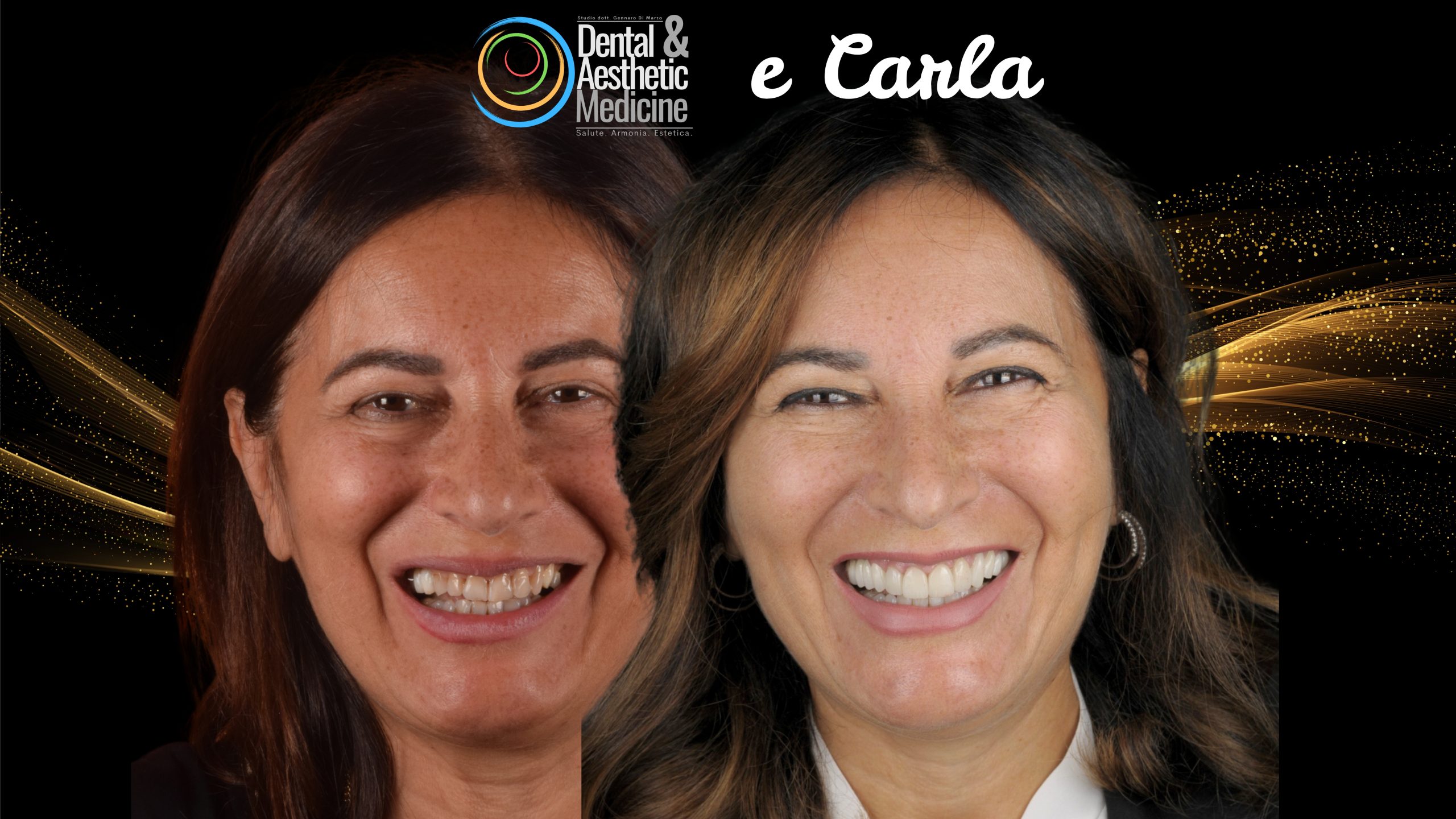 Faccette Dentista Faccette Sui Denti 12 Scaled