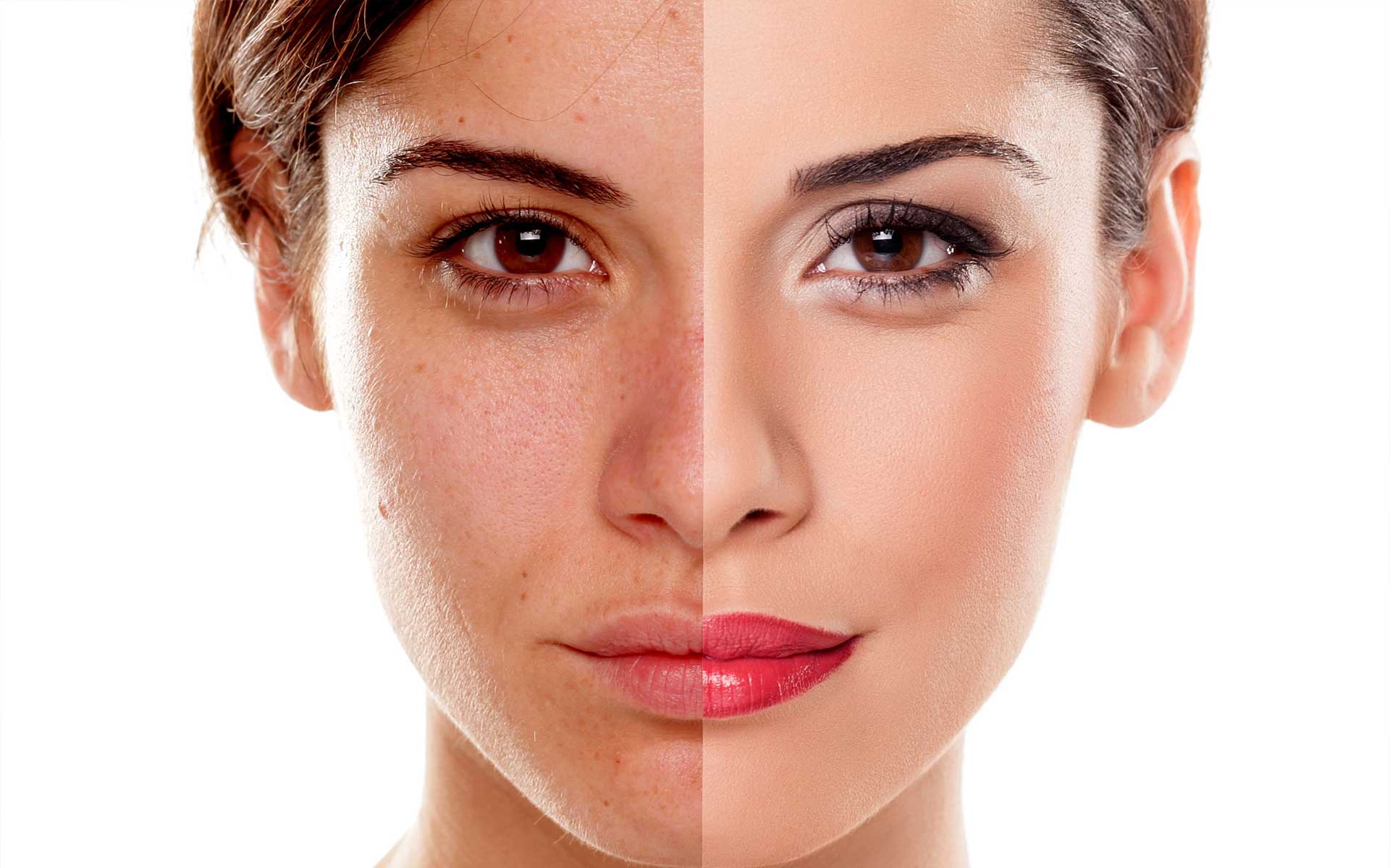 https://estetica-dentale.it/wp-content/uploads/2022/05/peeling2.jpg